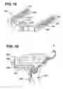 Fig. 14 - Methods and apparatus for orthopedic implant preparation systems