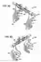 Fig. 16 - Methods and apparatus for orthopedic implant preparation systems
