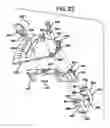 Fig. 22 - Methods and apparatus for orthopedic implant preparation systems