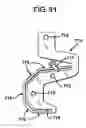 Fig. 25 - Methods and apparatus for orthopedic implant preparation systems