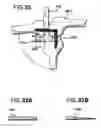 Fig. 26 - Methods and apparatus for orthopedic implant preparation systems