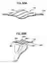 Fig. 27 - Methods and apparatus for orthopedic implant preparation systems