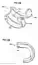 Fig. 32 - Methods and apparatus for orthopedic implant preparation systems