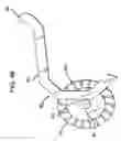 Fig. 40 - Methods and apparatus for orthopedic implant preparation systems