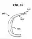 Fig. 41 - Methods and apparatus for orthopedic implant preparation systems