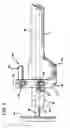Fig. 03 - Methods and apparatus for orthopedic implants