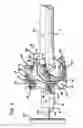 Fig. 05 - Methods and apparatus for orthopedic implants