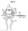 Fig. 09 - Methods and apparatus for orthopedic implants
