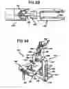 Fig. 19 - Methods and apparatus for orthopedic implants