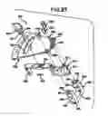Fig. 22 - Methods and apparatus for orthopedic implants