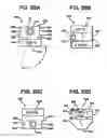 Fig. 23 - Methods and apparatus for orthopedic implants