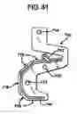 Fig. 25 - Methods and apparatus for orthopedic implants