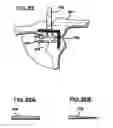 Fig. 26 - Methods and apparatus for orthopedic implants