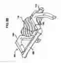 Fig. 29 - Methods and apparatus for orthopedic implants