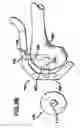 Fig. 30 - Methods and apparatus for orthopedic implants