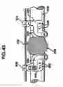 Fig. 34 - Methods and apparatus for orthopedic implants
