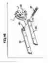 Fig. 37 - Methods and apparatus for orthopedic implants