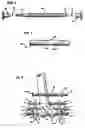 Fig. 04 - Methods and apparatus for orthopedic surgical navigation and alignment