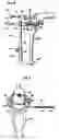 Fig. 05 - Methods and apparatus for orthopedic surgical navigation and alignment