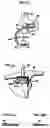Fig. 13 - Methods and apparatus for orthopedic surgical navigation and alignment