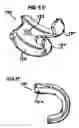 Fig. 17 - Methods and apparatus for orthopedic surgical navigation and alignment