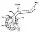 Fig. 23 - Methods and apparatus for orthopedic surgical navigation and alignment