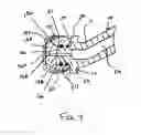 Fig. 10 - Method of implanting an acetabular shell