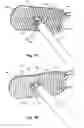 Fig. 10 - Methods and apparatus for forming a tunnel through a proximal end of a tibia