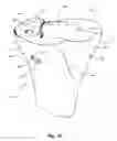 Fig. 11 - Methods and apparatus for forming a tunnel through a proximal end of a tibia