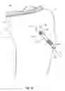 Fig. 19 - Methods and apparatus for forming a tunnel through a proximal end of a tibia