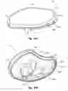 Fig. 28 - Methods and apparatus for forming a tunnel through a proximal end of a tibia
