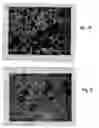 Fig. 07 - Repair of spinal annular defects and annulo-nucleoplasty regeneration