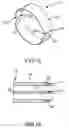 Fig. 06 - Splittable cannula having radiopaque marker