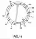 Fig. 08 - Splittable cannula having radiopaque marker