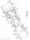 Fig. 09 - Splittable cannula having radiopaque marker