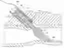 Fig. 01 - Device and method for suturing of internal puncture sites