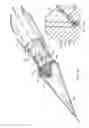 Fig. 05 - Device and method for suturing of internal puncture sites