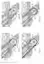 Fig. 10 - Device and method for suturing of internal puncture sites