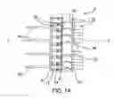 Fig. 02 - Anastomosis device, tools and method of using