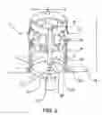 Fig. 04 - Anastomosis device, tools and method of using