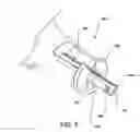 Fig. 07 - Anastomosis device, tools and method of using
