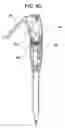 Fig. 16 - Anastomosis device, tools and method of using