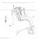 Fig. 22 - Anastomosis device, tools and method of using