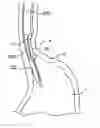 Fig. 01 - Devices and methods for tissue invagination