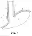 Fig. 02 - Devices and methods for tissue invagination