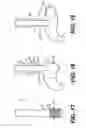 Fig. 14 - Devices and methods for tissue invagination