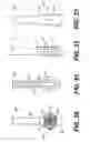 Fig. 15 - Devices and methods for tissue invagination