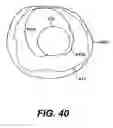 Fig. 29 - Devices and methods for tissue invagination