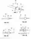 Fig. 03 - Mechanisms and methods used in the anastomosis of biological conduits
