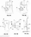 Fig. 06 - Mechanisms and methods used in the anastomosis of biological conduits